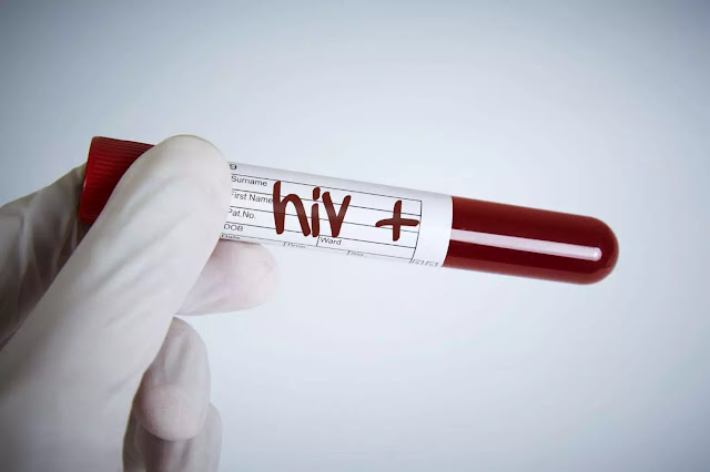HIV: novos casos caem 43% no mundo desde 2010, mas crescem no Brasil